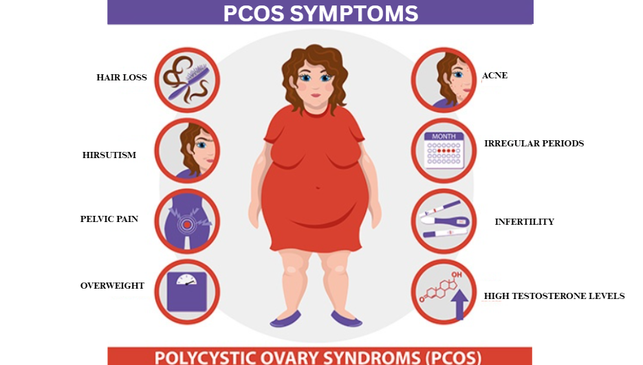 PCOS Symptoms